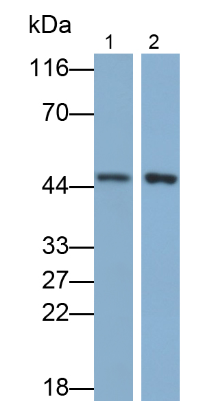Polyclonal Antibody to Proteasome 26S Subunit, Non ATPase 6 (PSMD6)