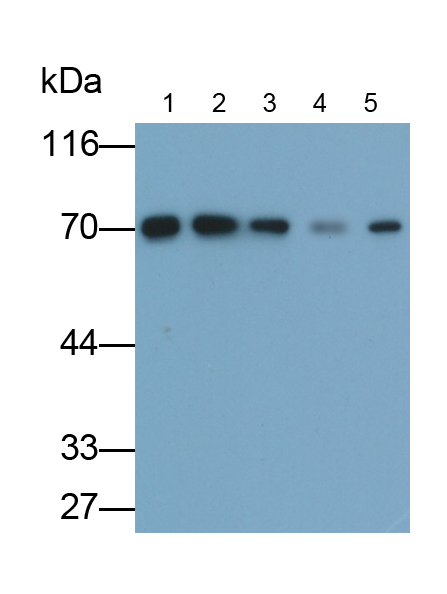 Polyclonal Antibody to Cytoskeleton Associated Protein 4 (CKAP4)