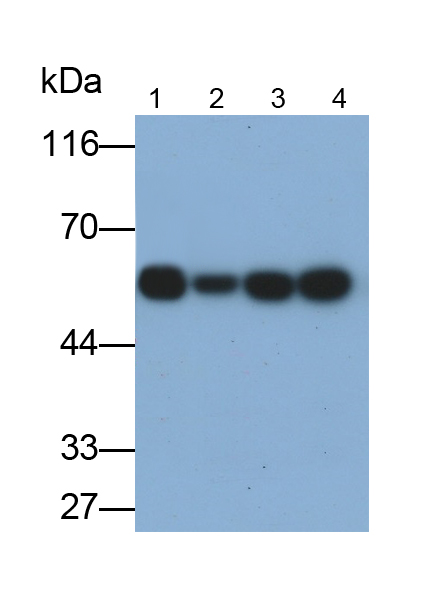 Polyclonal Antibody to Tubulin Alpha 1C (TUBa1C)