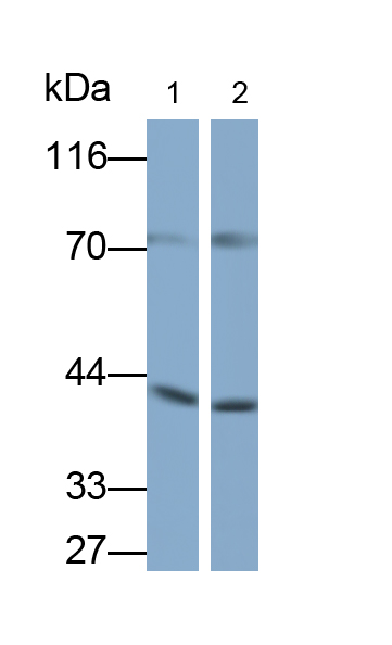Polyclonal Antibody to RNA Binding Motif Protein, X-Linked 2 (RBMX2)