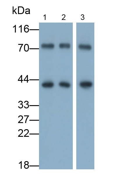 Polyclonal Antibody to RNA Binding Motif Protein, X-Linked 2 (RBMX2)