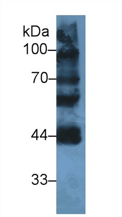 Polyclonal Antibody to Ly1 Antibody Reactive Homolog (LYAR)