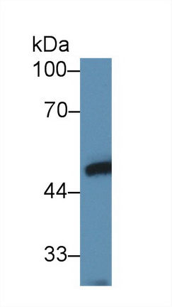 Polyclonal Antibody to Ly1 Antibody Reactive Homolog (LYAR)