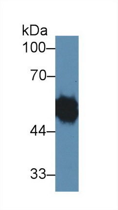 Polyclonal Antibody to Ly1 Antibody Reactive Homolog (LYAR)