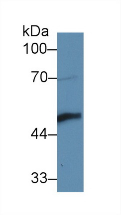 Polyclonal Antibody to Ly1 Antibody Reactive Homolog (LYAR)