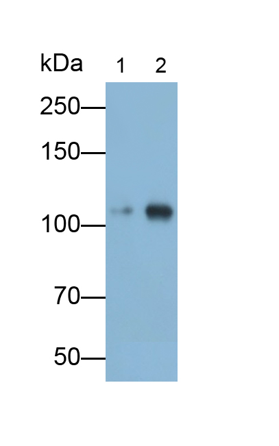 Polyclonal Antibody to Complement Component 4d (C4d)