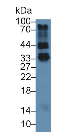 Polyclonal Antibody to Folate Receptor 4 (FOLR4)