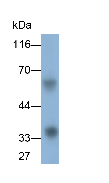 Polyclonal Antibody to Short Palate, Lung And Nasal Epithelium Carcinoma Associated Protein 2 (SPLUNC2)