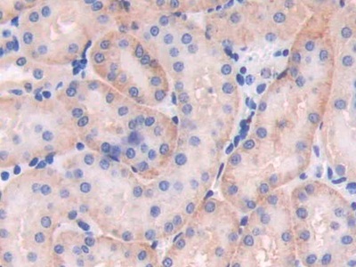 Polyclonal Antibody to Mab21 Domain Containing Protein 1 (MB21D1)