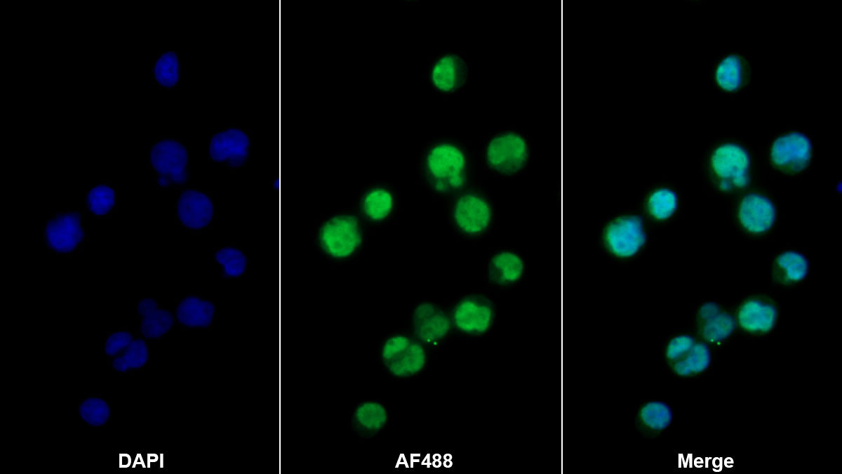 Polyclonal Antibody to Zinc Finger Protein 831 (ZNF831)