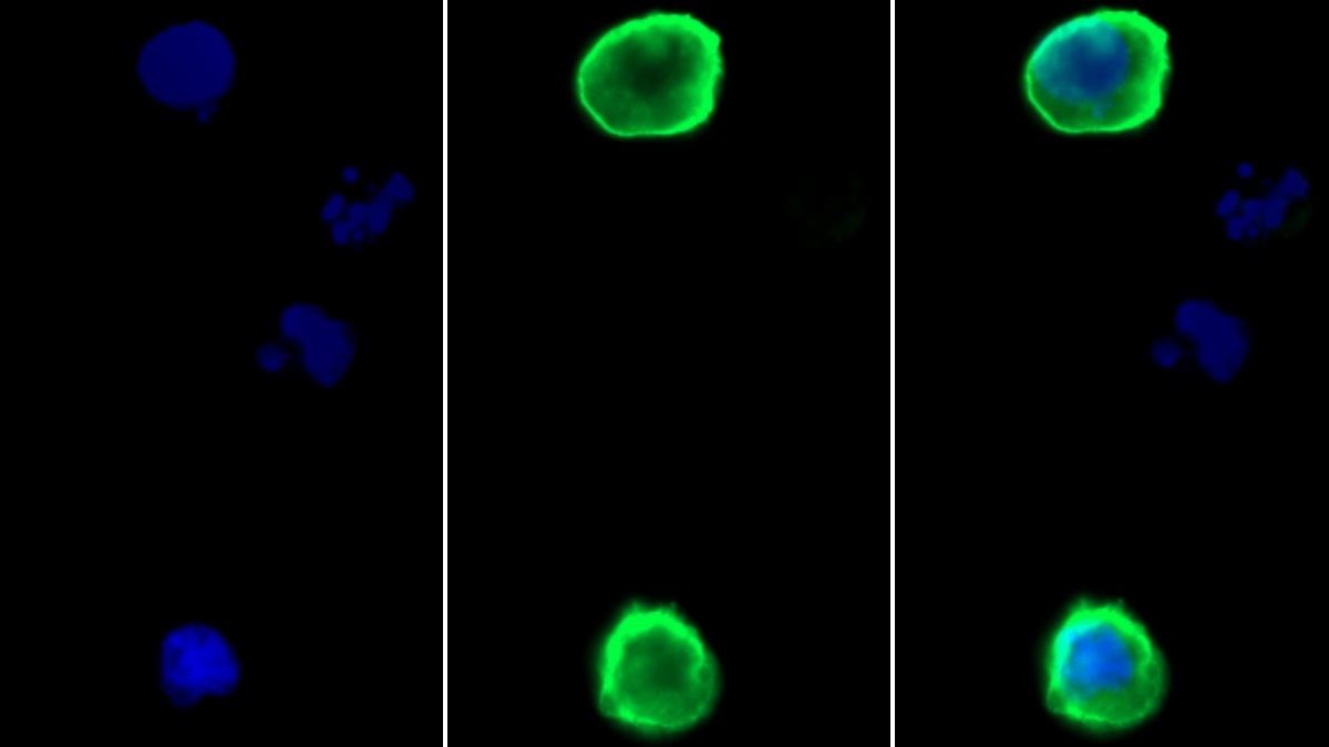 Recombinant Antibody to Programmed Cell Death Protein 1 Ligand 1 (PDL1)