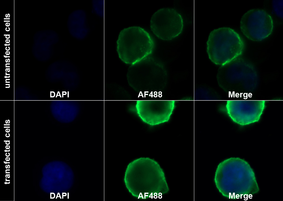Recombinant Antibody to Interleukin 7 Receptor (IL7R)