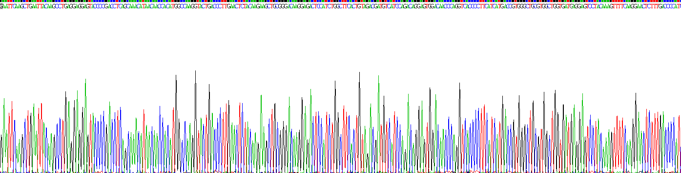 Recombinant Creatine Kinase, Muscle (CKM)