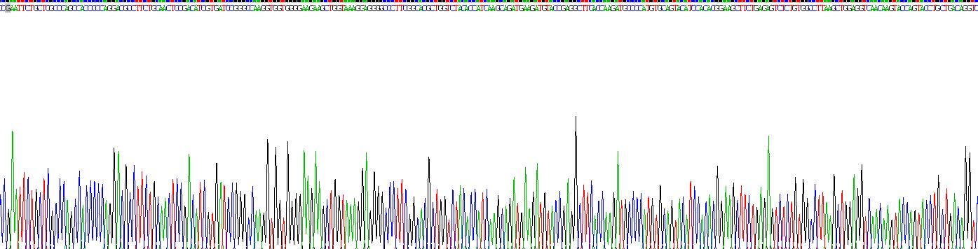 Recombinant Tissue Inhibitors Of Metalloproteinase 3 (TIMP3)