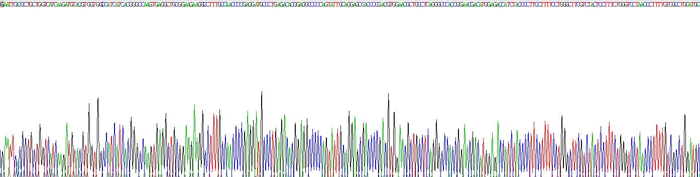 Recombinant Prostaglandin E Synthase, Microsomal (PTGES)