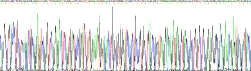 Recombinant Alpha-1-Microglobulin (a1M)