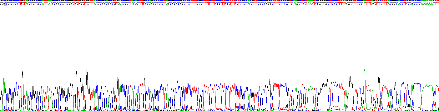 Recombinant Beta-2-Microglobulin (b2M)