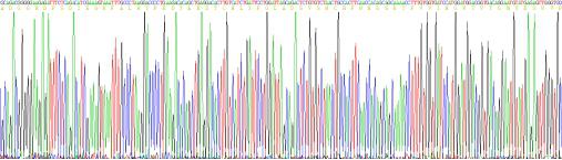 Recombinant Lipoprotein lipase (LPL)