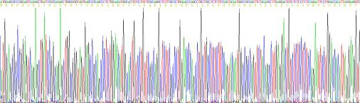 Recombinant Neuroglobin (NGB)