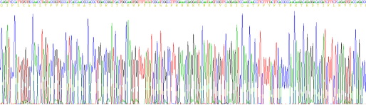 Recombinant Alpha-1-Acid Glycoprotein (a1AGP)