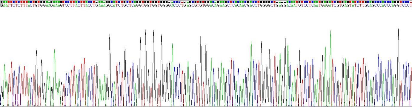 Recombinant Death receptor 5 (DR5)