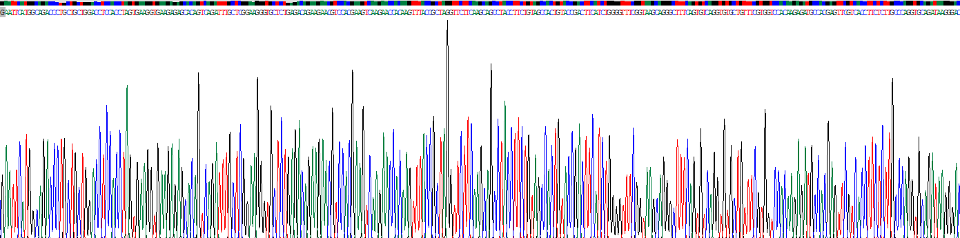 Recombinant Protein Kinase C Beta 1 (PKCb1)