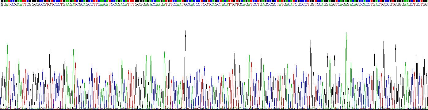 Recombinant Deoxyribonuclease I (DNASE1)