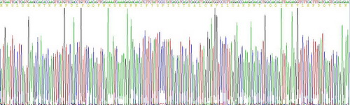 Recombinant Serpin B3 (SERPINB3)