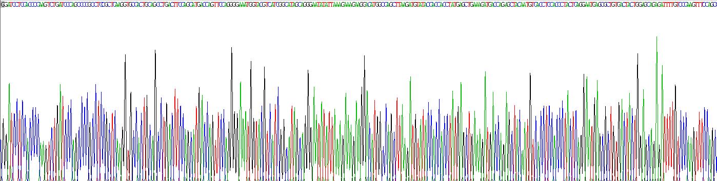 Recombinant Neutrophil gelatinase-associated lipocalin (NGAL)