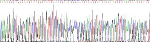 Recombinant Interleukin 3 Receptor Alpha (IL3Ra)