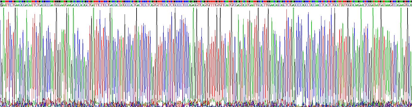 Recombinant Interleukin 2 Receptor Gamma (IL2Rg)