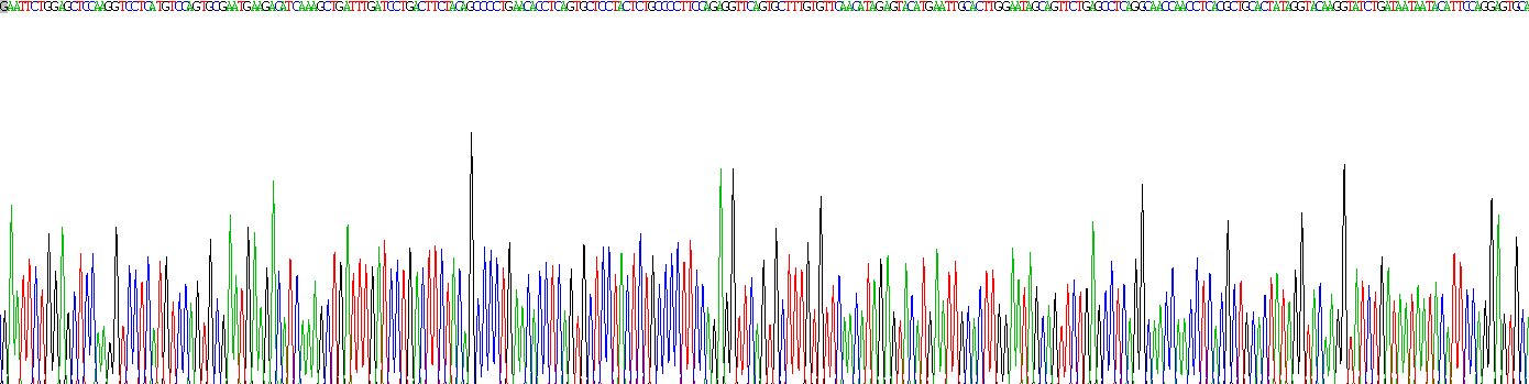 Recombinant Interleukin 2 Receptor Gamma (IL2Rg)