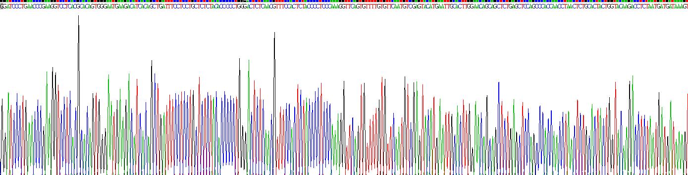 Recombinant Interleukin 2 Receptor Gamma (IL2Rg)