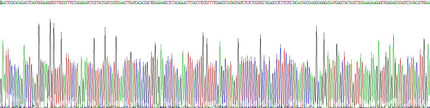 Recombinant Serum Amyloid P Component (SAP)