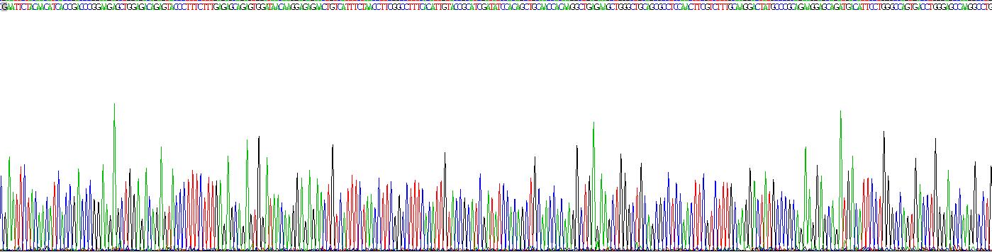 Recombinant Insulin Like Growth Factor 1 Receptor (IGF1R)