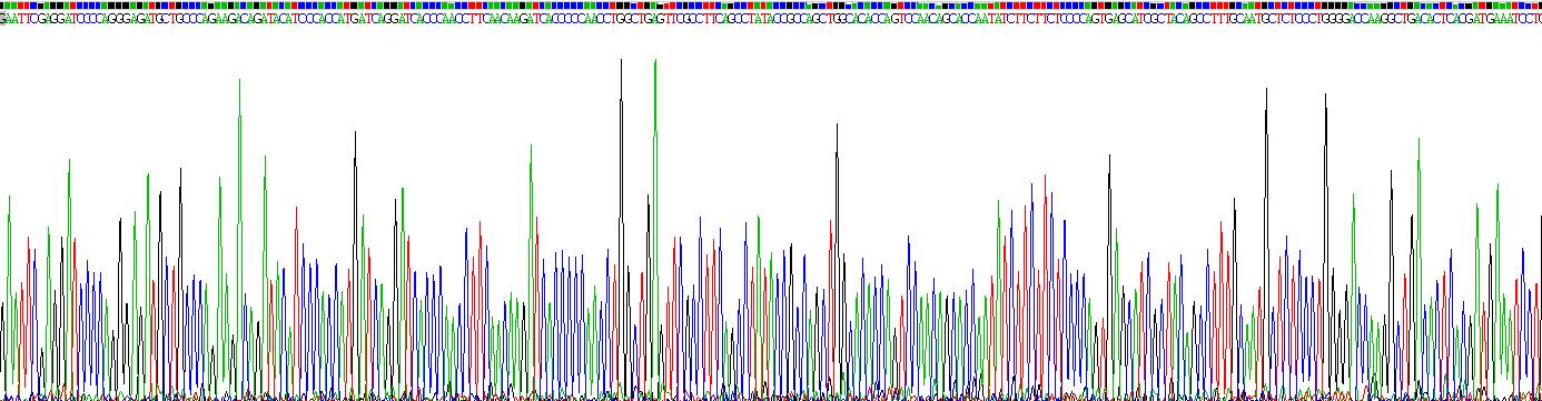 Recombinant Alpha-1-Antitrypsin (a1AT)