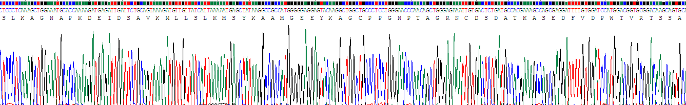 Recombinant Tryptophanyl tRNA Synthetase (WARS)