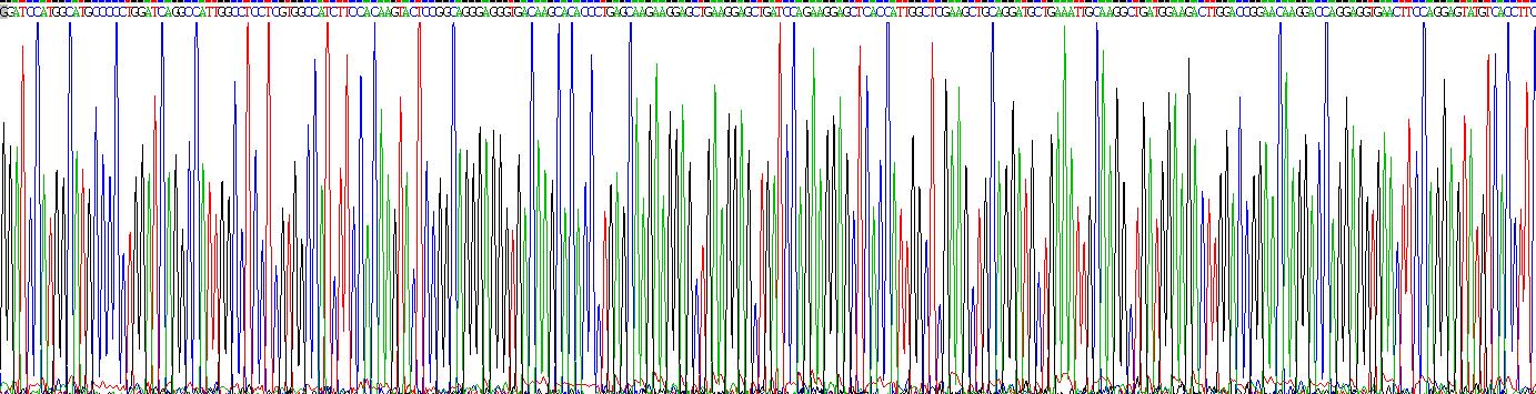 Recombinant S100 Calcium Binding Protein A6 (S100A6)