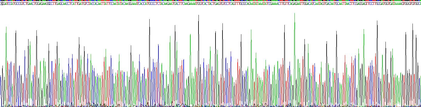 Recombinant S100 Calcium Binding Protein A8 (S100A8)