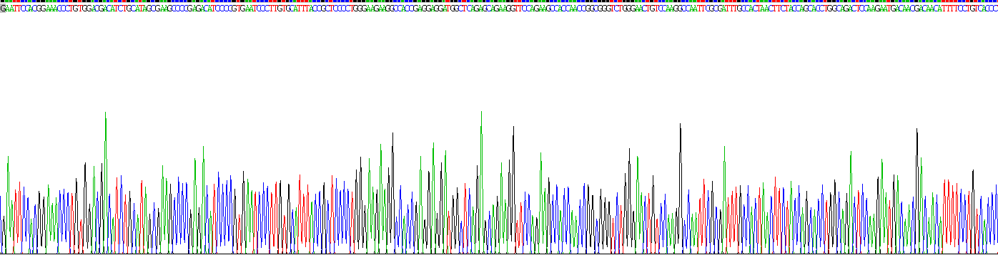 Recombinant Antithrombin (AT)