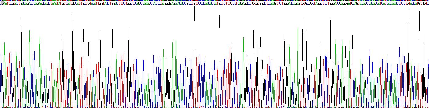 Recombinant Glucocerebrosidase (GBA)