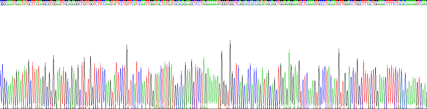 Recombinant Prostate-specific Membrane Antigen (PMSA)