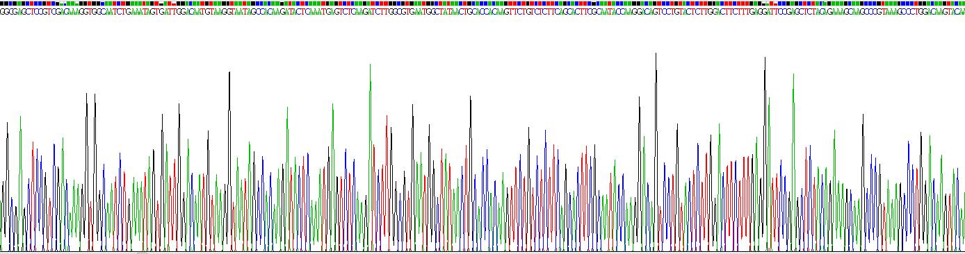 Recombinant Histidine Rich Glycoprotein (HRG)