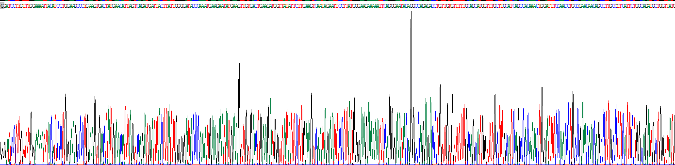 Recombinant Lipase, Gastric (LIPF)