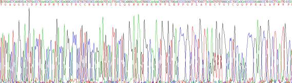 Recombinant Left/Right Determination Factor 2 (LEFTY2)