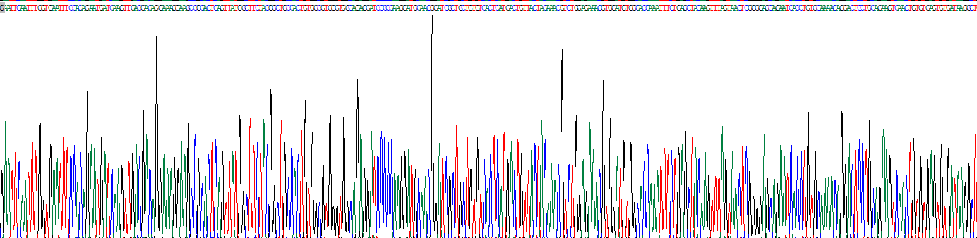 Recombinant Phospholipase A2, Group IIA (PLA2G2A)