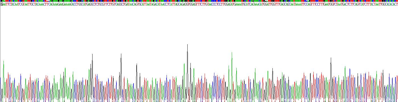 Recombinant Phospholipase A2 Receptor 1 (PLA2R1)