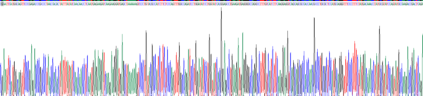 Recombinant Small Nuclear Ribonucleoprotein Polypeptide A (SNRPA)