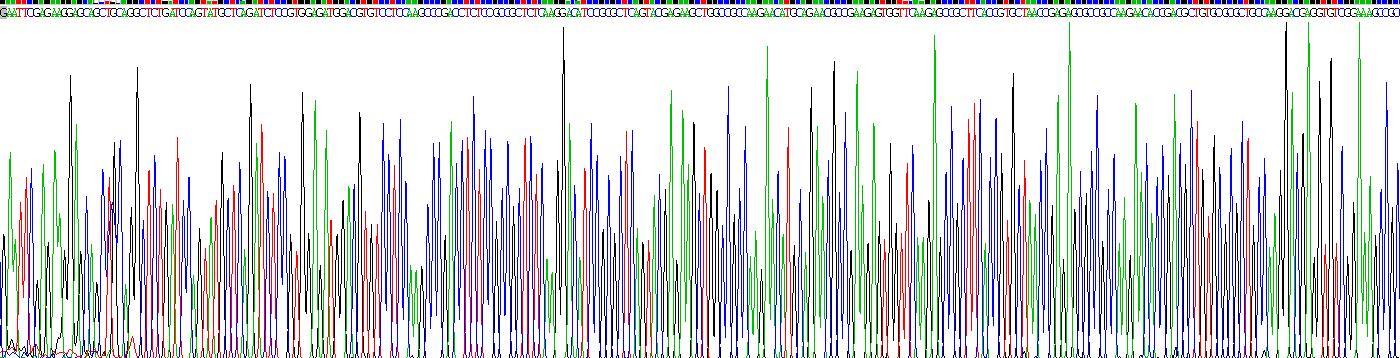 Recombinant Neurofilament, Light Polypeptide (NEFL)