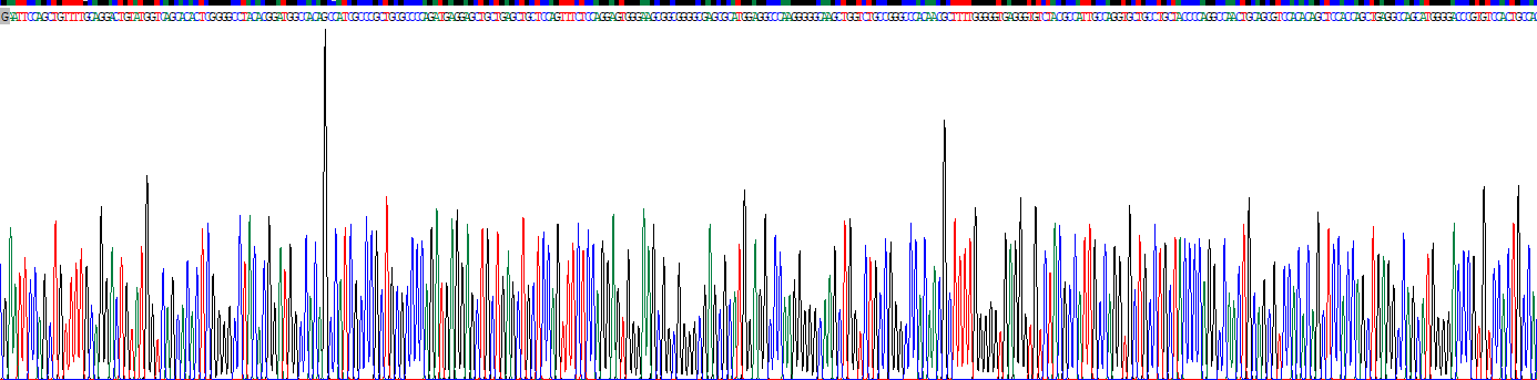 Recombinant Proprotein Convertase Subtilisin/Kexin Type 9 (PCSK9)
